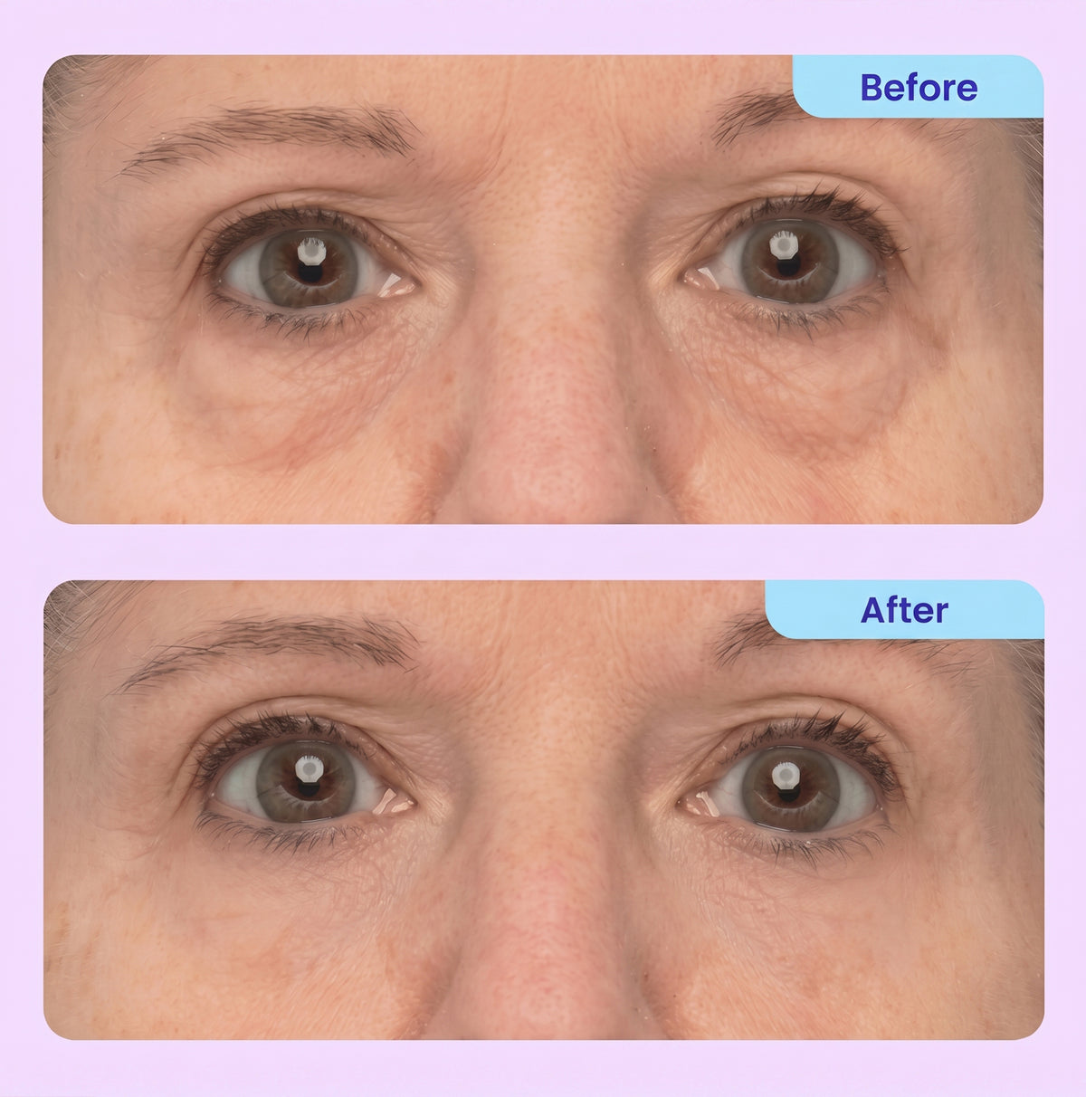 Instant Lift Eye Gel