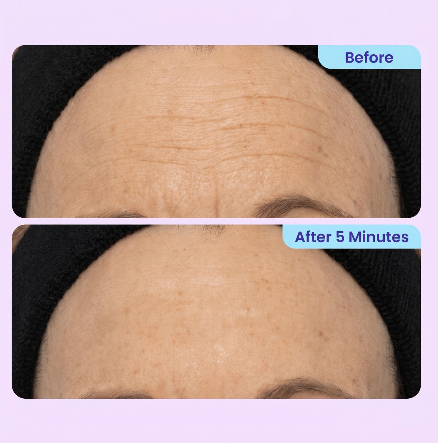 Instant Lift Eye Gel